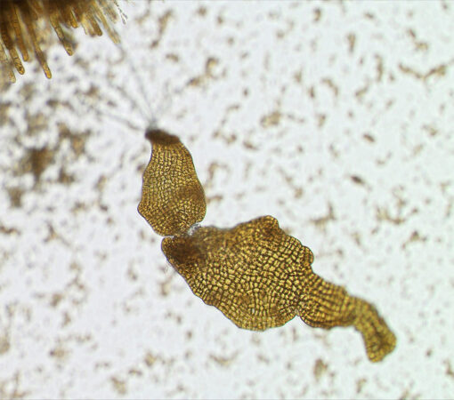 a microscopic image of a baby giant kelp